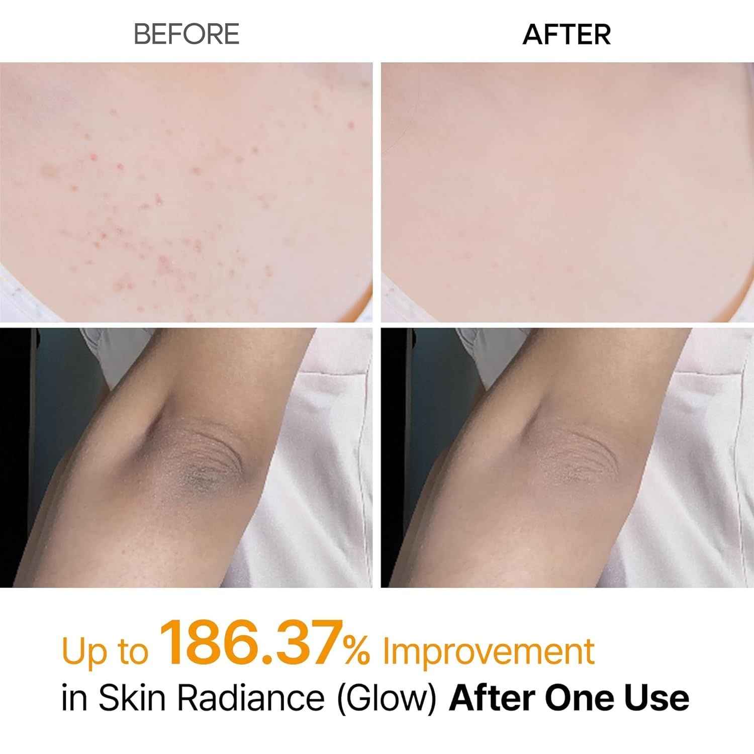 Dr.Melaxin Body Keratin Care Kojic Acid Turmeric Spray Gently Exfoliating Peeling Solution Korean Skincare All Skin Types 200ml